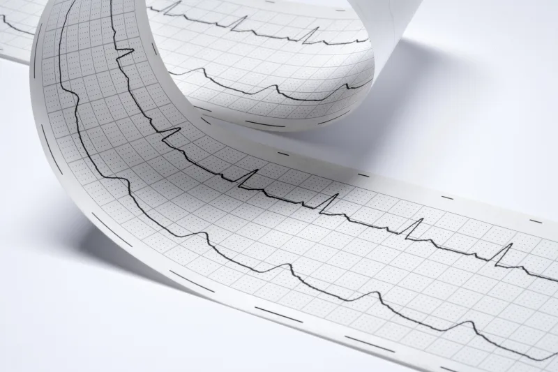 Electrocardiograma en Clínica San Javier