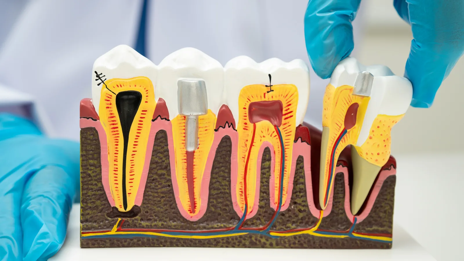 Periodoncista evaluando la salud de las encías de un paciente en Clínica San Javier