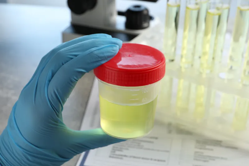 Uroflujometría en Clínica San Javier